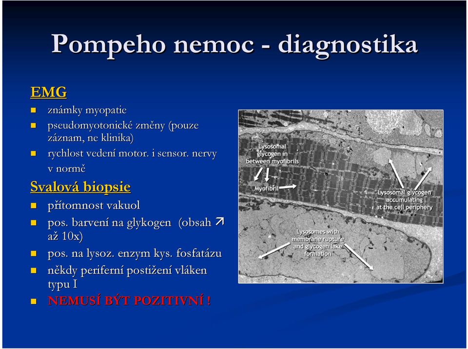 . nervy v normě Svalová biopsie přítomnost vakuol pos.