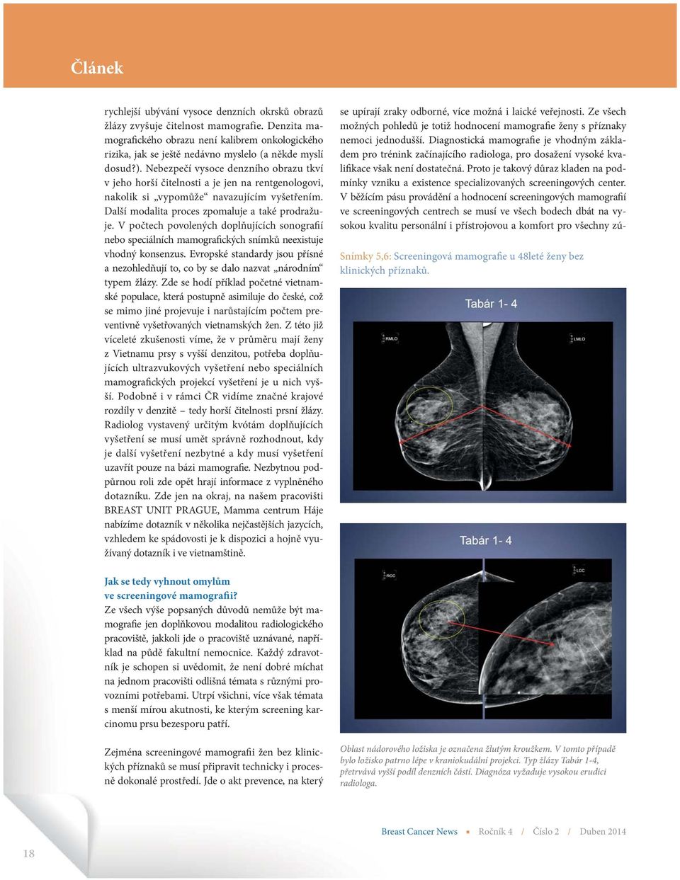 V počtech povolených doplňujících sonografií nebo speciálních mamografických snímků neexistuje vhodný konsenzus.