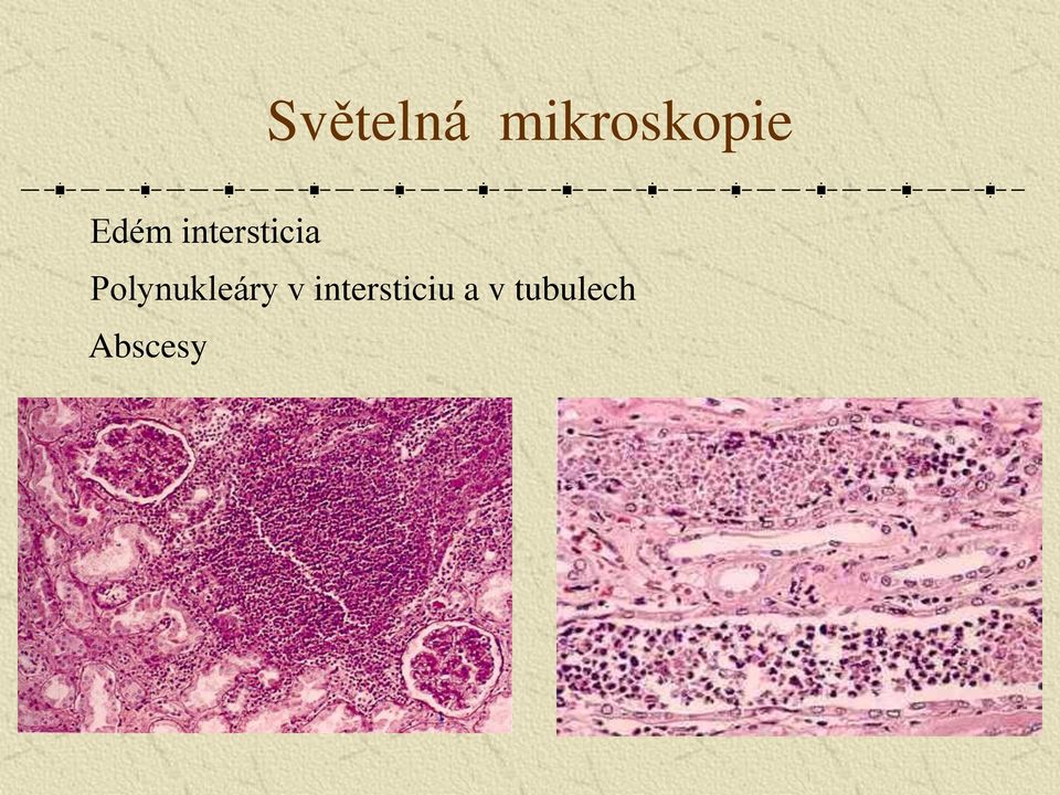 Polynukleáry v