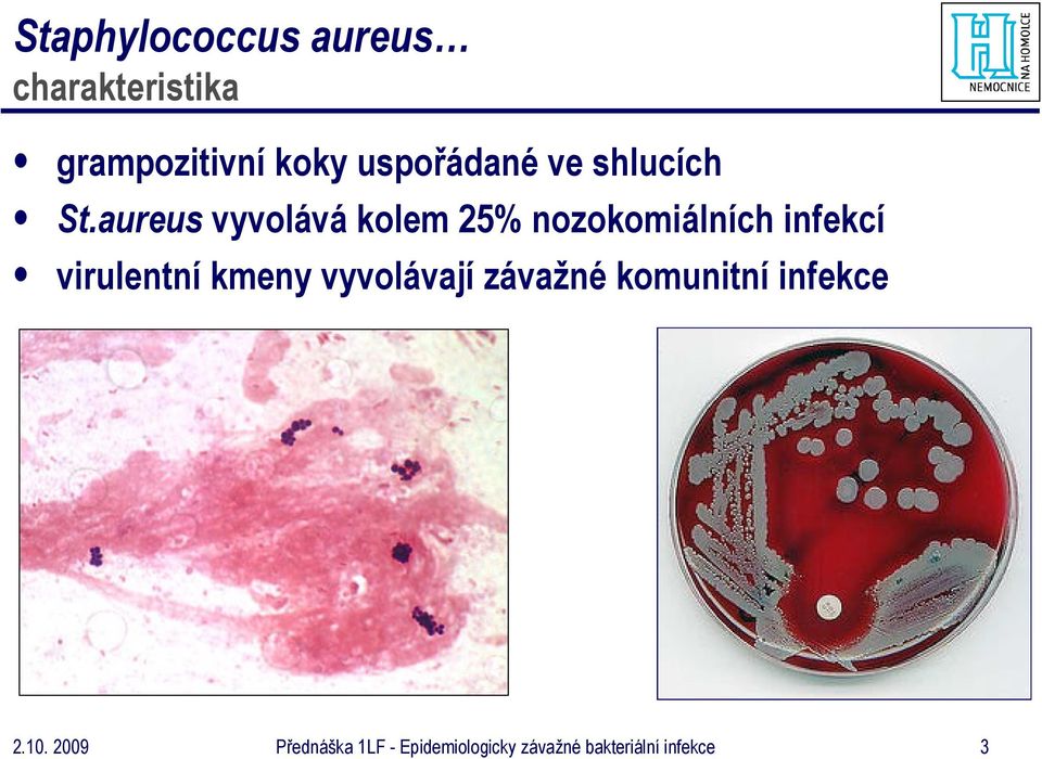 aureus vyvolává kolem 25% nozokomiálních