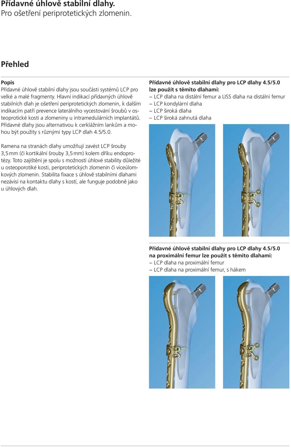 intramedulárních implantátů. Přídavné dlahy jsou alternativou k cerklážním lankům a mohou být použity s různými typy LCP dlah 4.5/5.