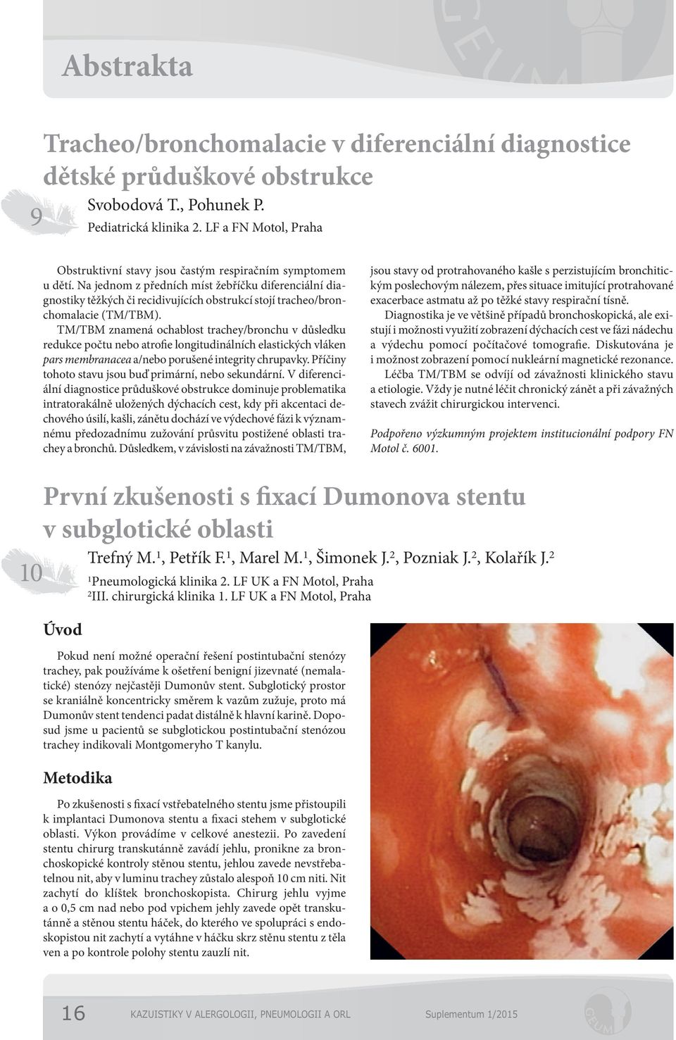 Na jednom z předních míst žebříčku diferenciální diagnostiky těžkých či recidivujících obstrukcí stojí tracheo/bronchomalacie (TM/TBM).