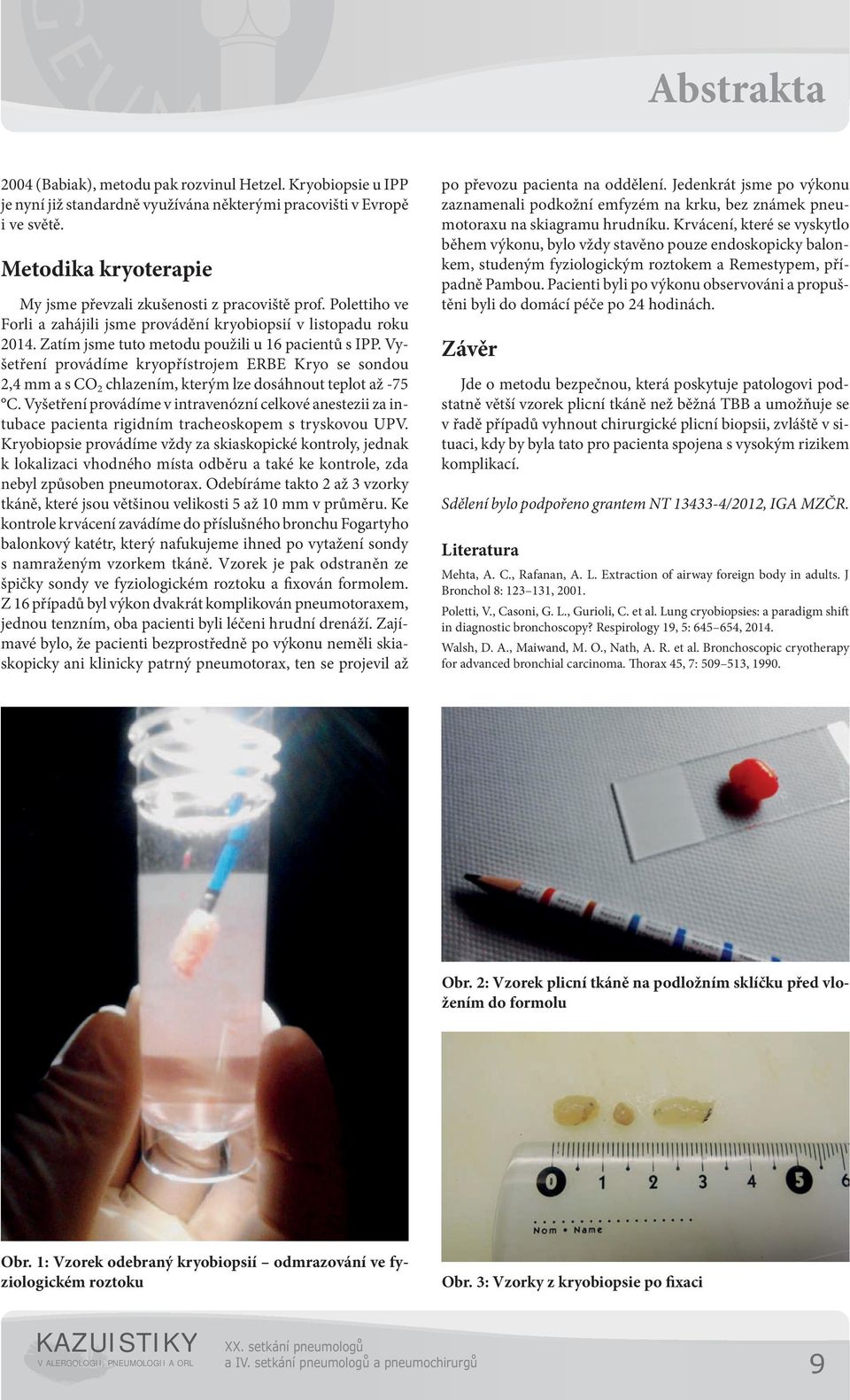 Vyšetření provádíme kryopřístrojem ERBE Kryo se sondou,4 mm a s CO chlazením, kterým lze dosáhnout teplot až -75 C.