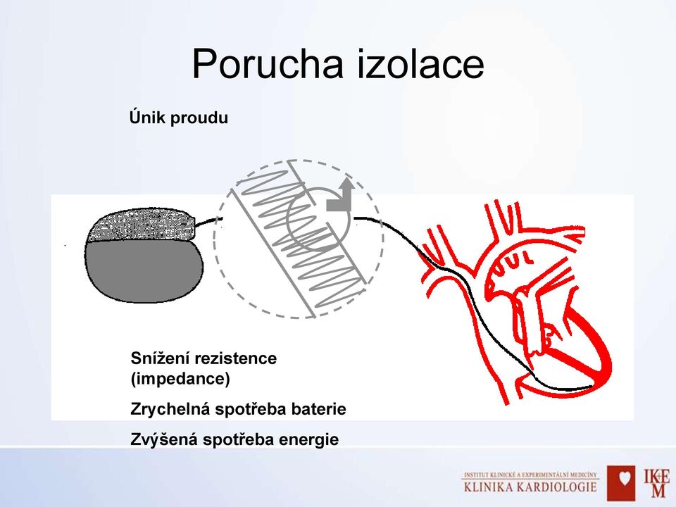 (impedance) Zrychelná