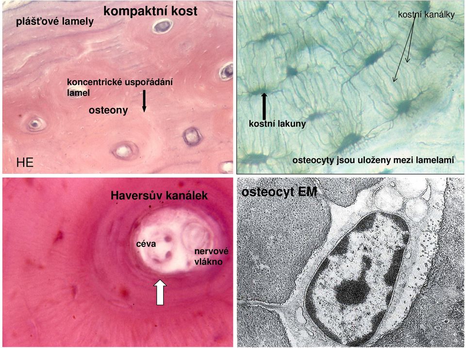 lakuny osteocyty jsou uloženy mezi lamelami HE