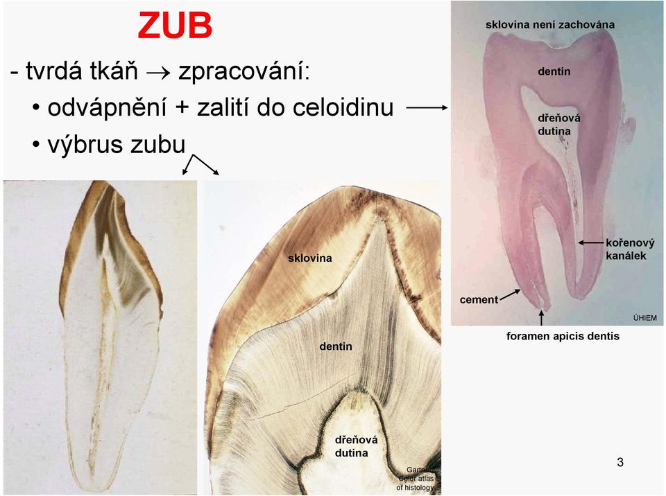 dutina sklovina kořenový kanálek cement ÚHIEM foramen