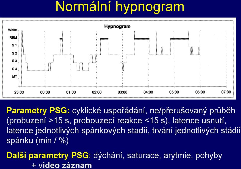 latence jednotlivých spánkových stadií, trvání jednotlivých stádií