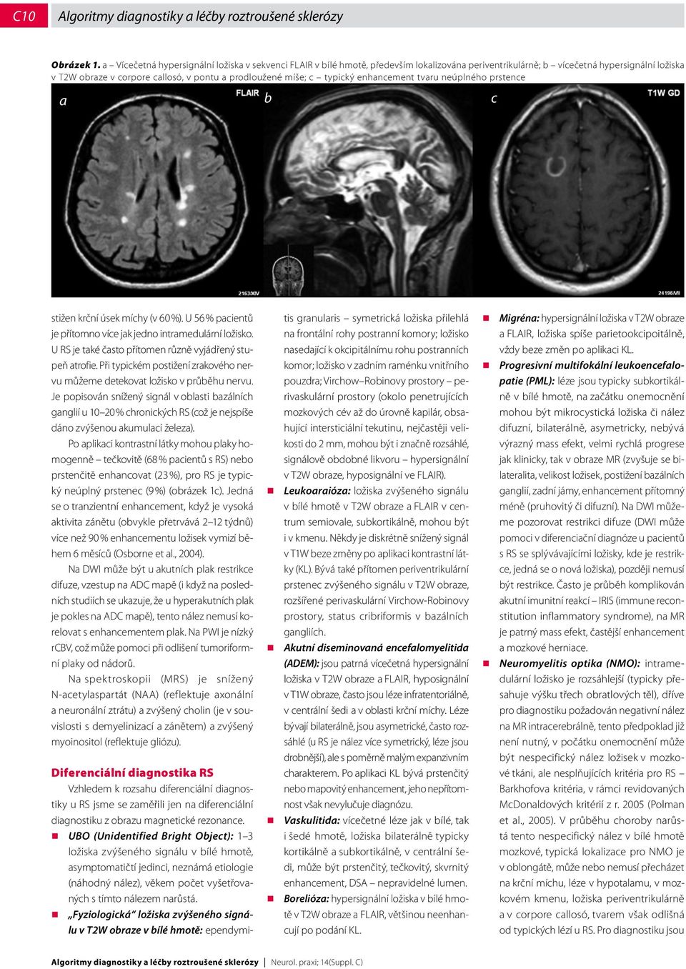míše; c typický enhancement tvaru neúplného prstence a b c stižen krční úsek míchy (v 60 %). U 56 % pacientů je přítomno více jak jedno intramedulární ložisko.