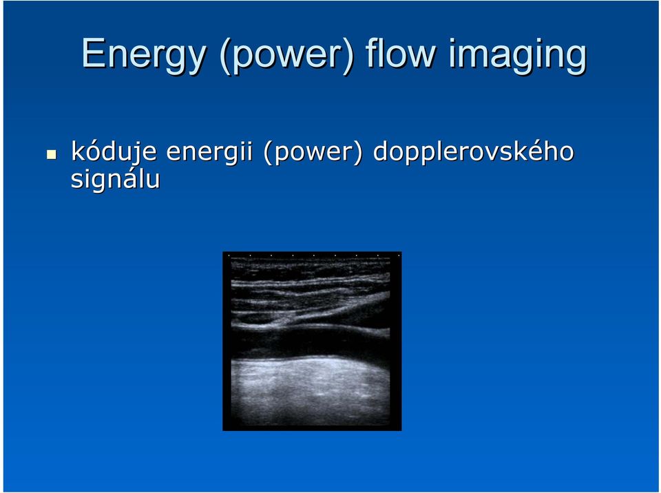 kóduje energii