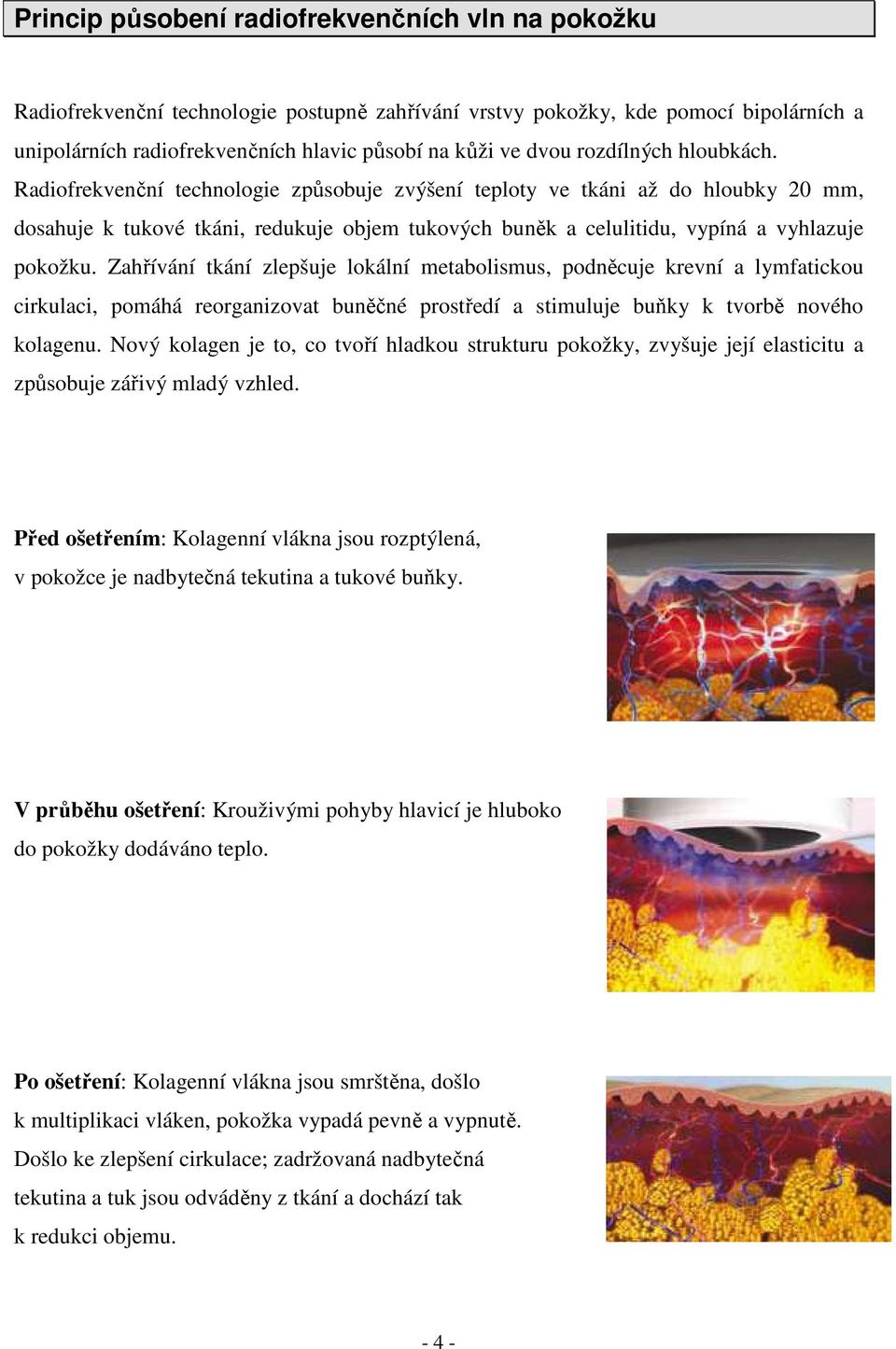 Radiofrekvenční technologie způsobuje zvýšení teploty ve tkáni až do hloubky 20 mm, dosahuje k tukové tkáni, redukuje objem tukových buněk a celulitidu, vypíná a vyhlazuje pokožku.