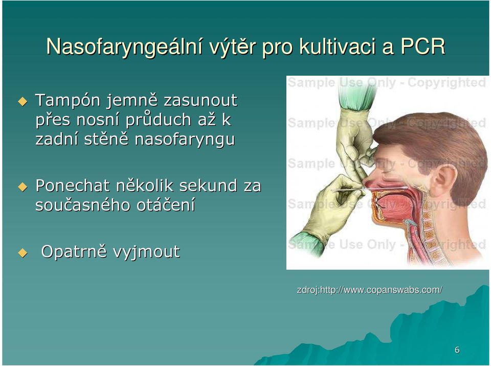 nasofaryngu Ponechat několik n sekund za současn asného