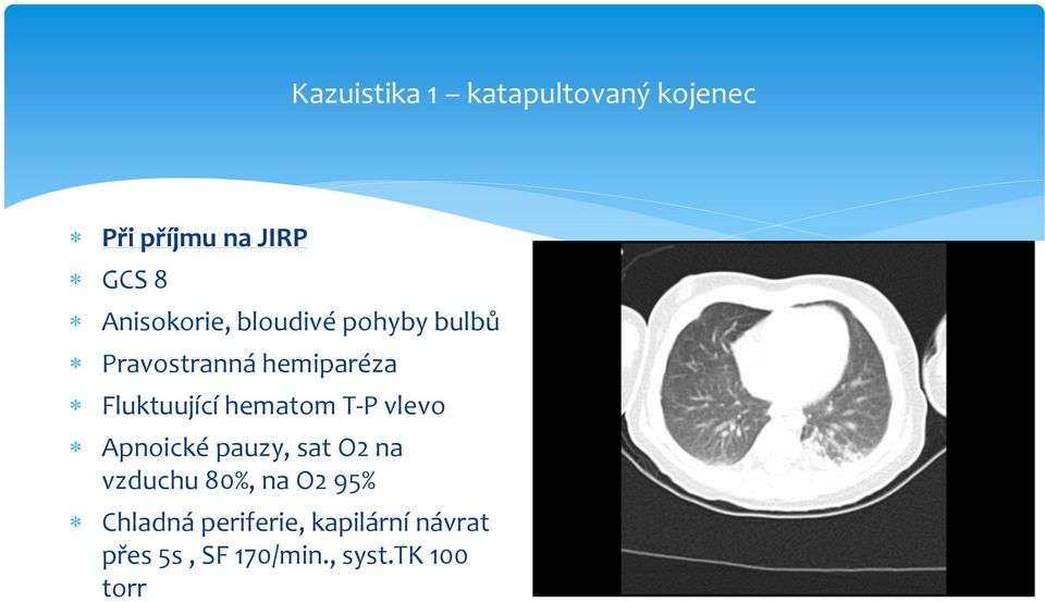 Fluktuující hematom T-P vlevo Apnoické pauzy, sat O2 na vzduchu