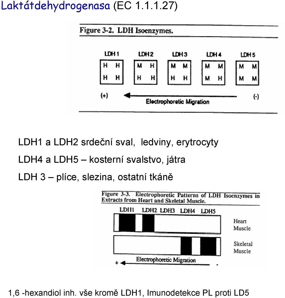 LDH4 a LDH5 kosterní svalstvo, játra LDH 3 plíce,