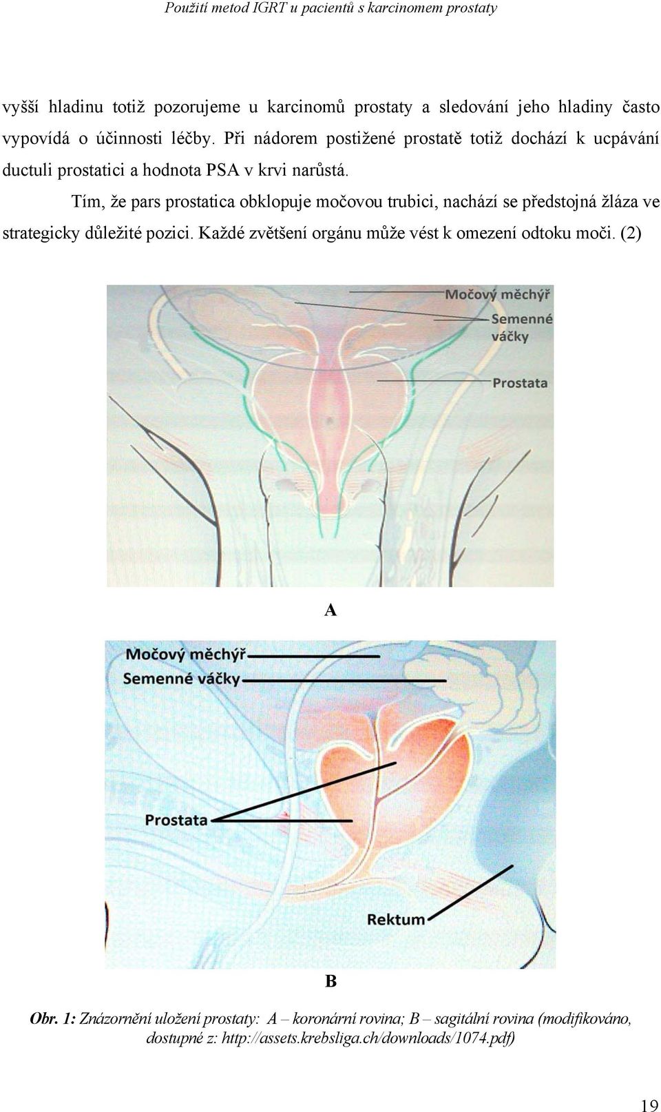 Tím, že pars prostatica obklopuje močovou trubici, nachází se předstojná žláza ve strategicky důležité pozici.