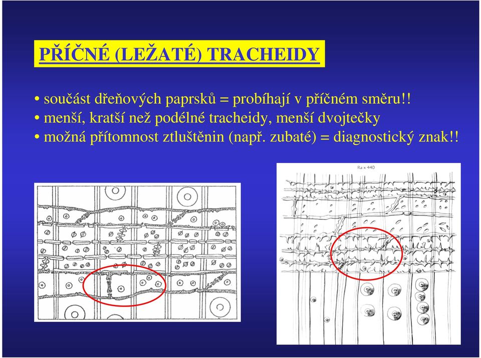 ! menší, kratší než podélné tracheidy, menší