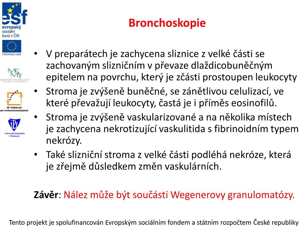 eosinofilů. Stroma je zvýšeně vaskularizované a na několika místech je zachycena nekrotizující vaskulitida s fibrinoidním typem nekrózy.