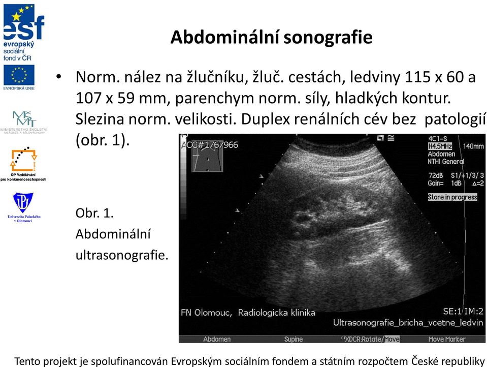 síly, hladkých kontur. Slezina norm. velikosti.