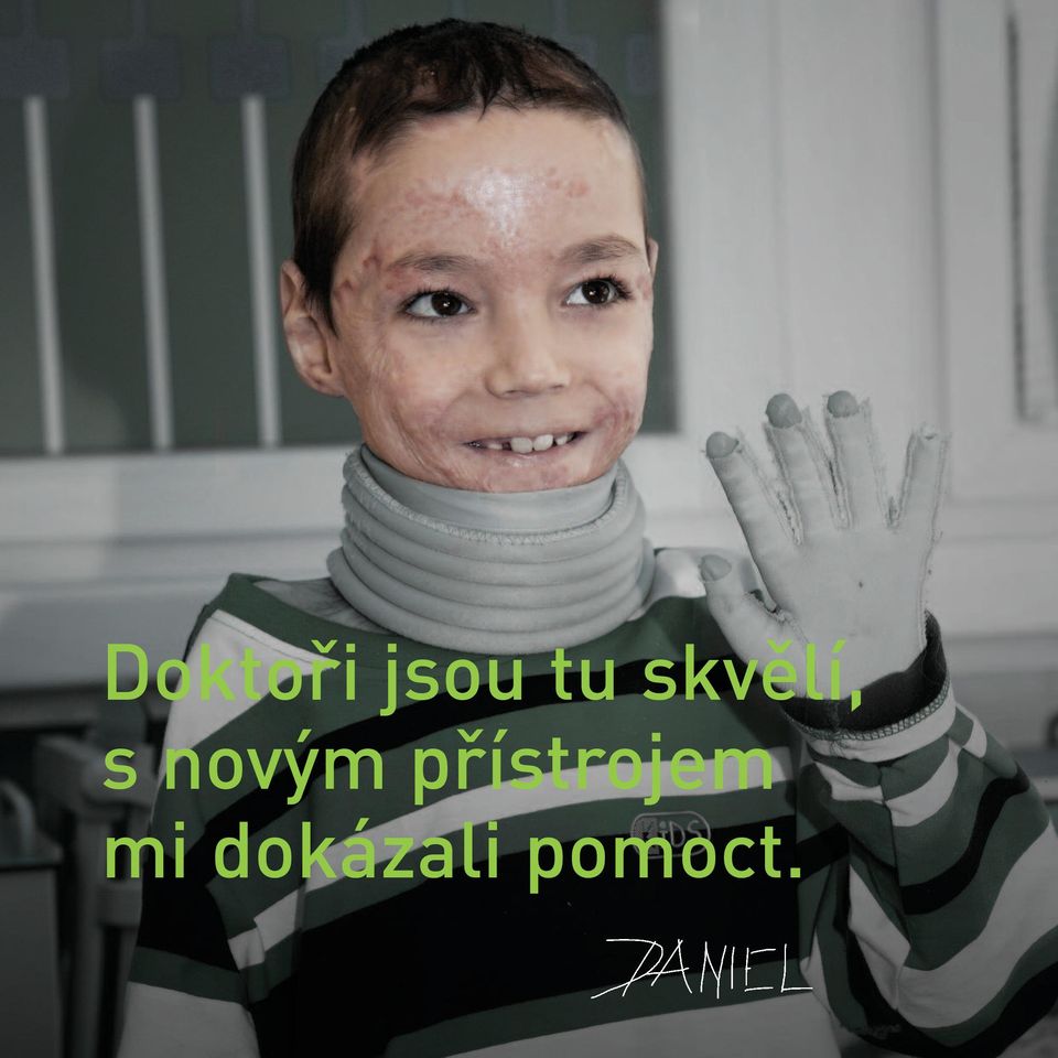 přístrojem mi