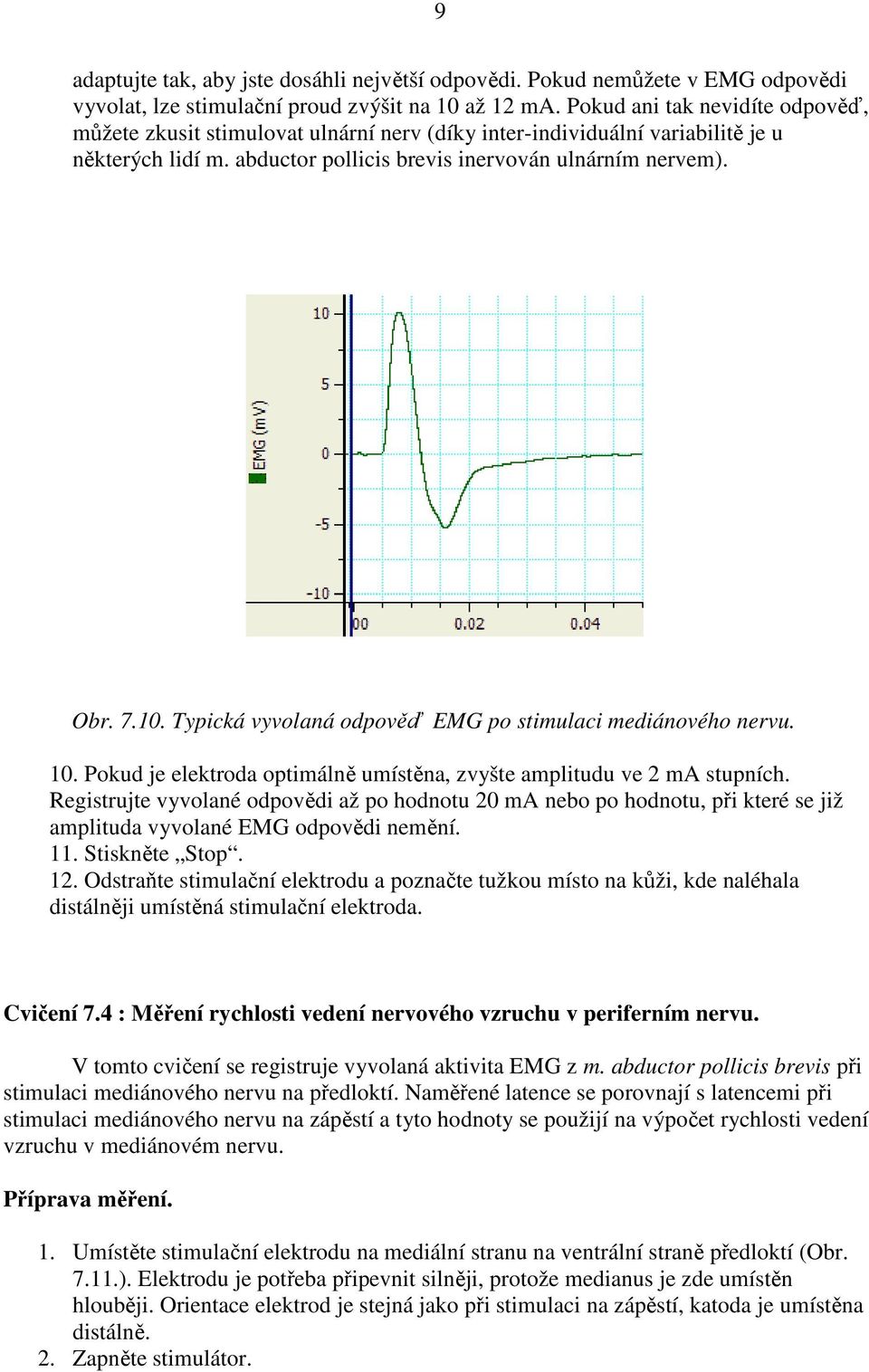 Typická vyvolaná odpověď EMG po stimulaci mediánového nervu. 10. Pokud je elektroda optimálně umístěna, zvyšte amplitudu ve 2 ma stupních.