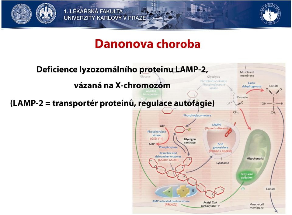 vázaná na X-chromozóm (LAMP-2 =