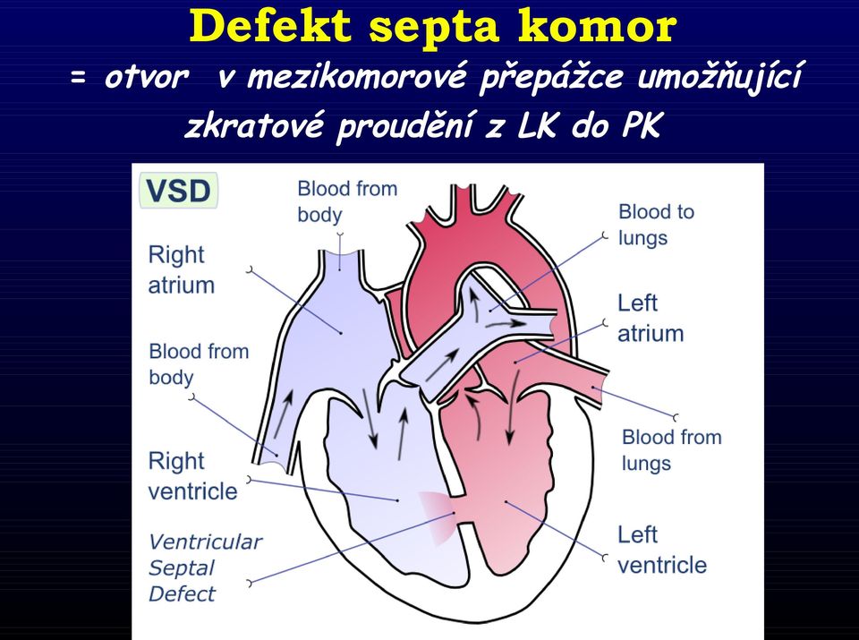 přepážce umožňující