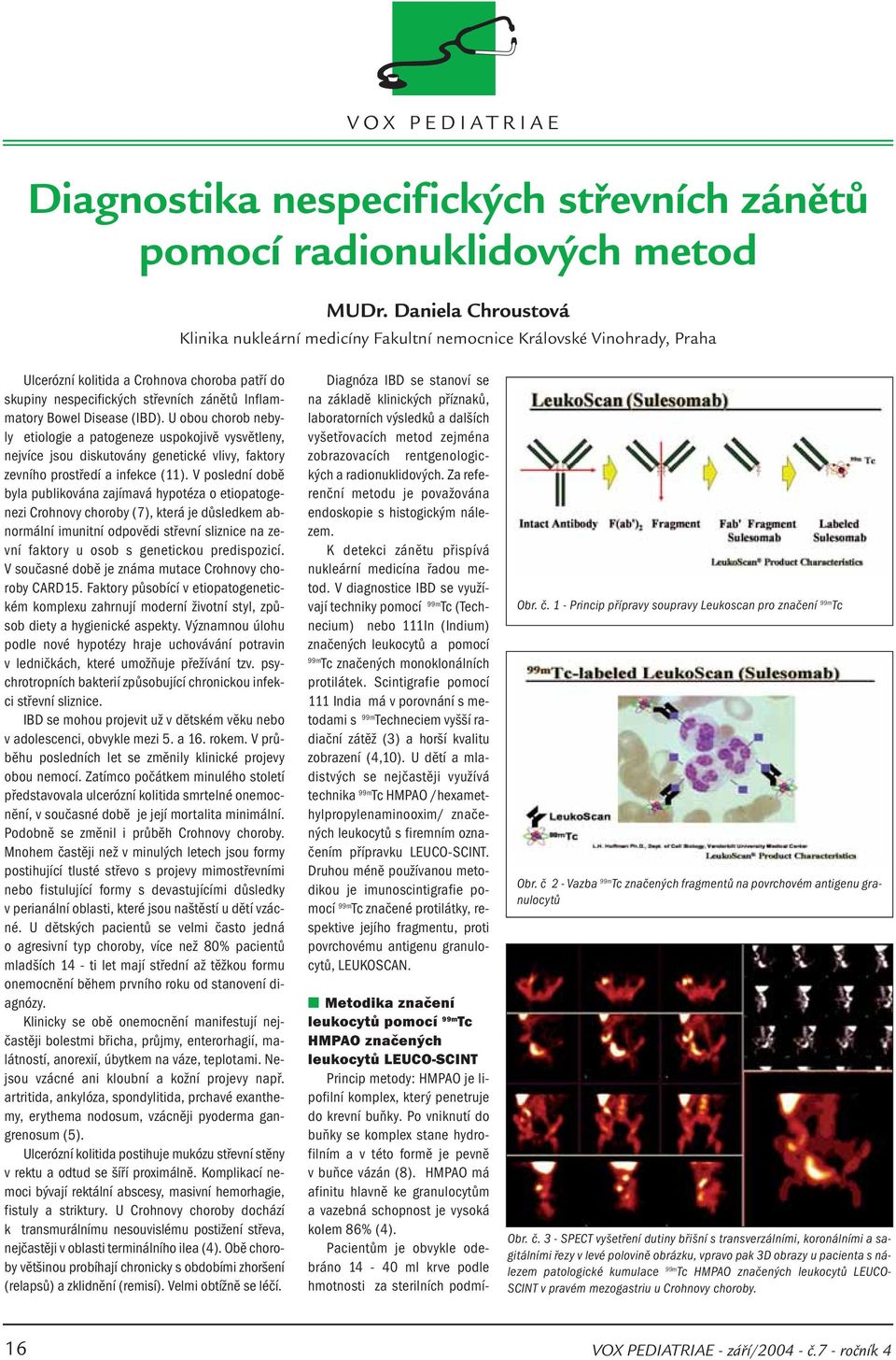 Disease (IBD). U obou chorob nebyly etiologie a patogeneze uspokojivě vysvětleny, nejvíce jsou diskutovány genetické vlivy, faktory zevního prostředí a infekce (11).