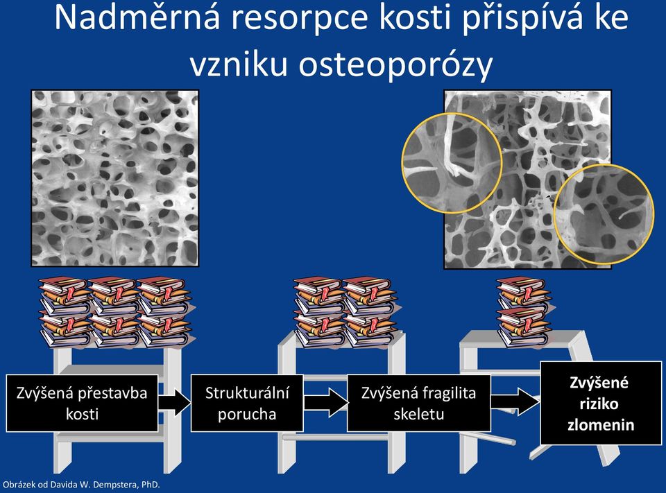 Strukturální porucha Zvýšená fragilita skeletu