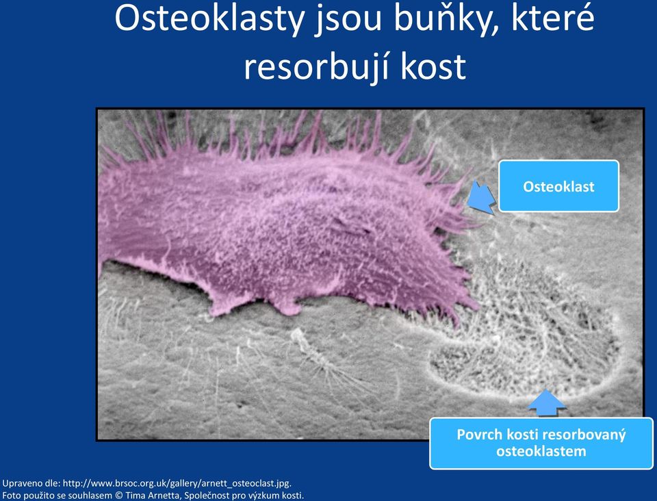 http://www.brsoc.org.uk/gallery/arnett_osteoclast.jpg.