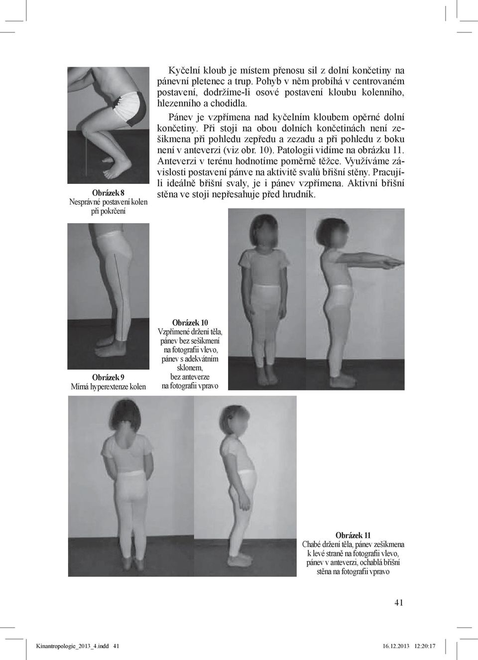 Při stoji na obou dolních končetinách není zešikmena při pohledu zepředu a zezadu a při pohledu z boku není v anteverzi (viz obr. 10). Patologii vidíme na obrázku 11.