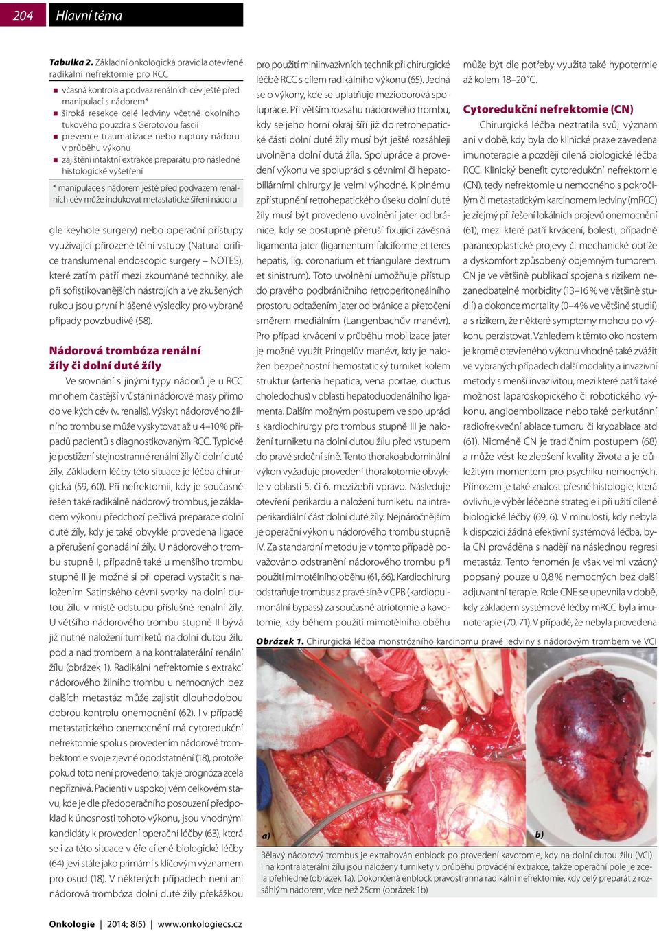 pouzdra s Gerotovou fascií prevence traumatizace nebo ruptury nádoru v průběhu výkonu zajištění intaktní extrakce preparátu pro následné histologické vyšetření * manipulace s nádorem ještě před