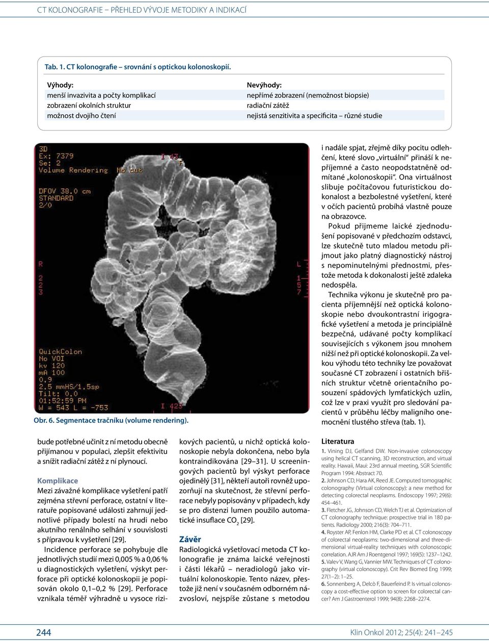 studie Obr. 6. Segmentace tračníku (volume rendering). i nadále spjat, zřejmě díky pocitu odlehčení, které slovo virtuální přináší k nepříjemné a často neopodstatněně odmítané kolonoskopii.