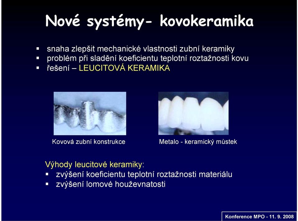 řešení LEUCITOVÁ KERAMIKA Kovová zubní konstrukce Metalo - keramický můstek