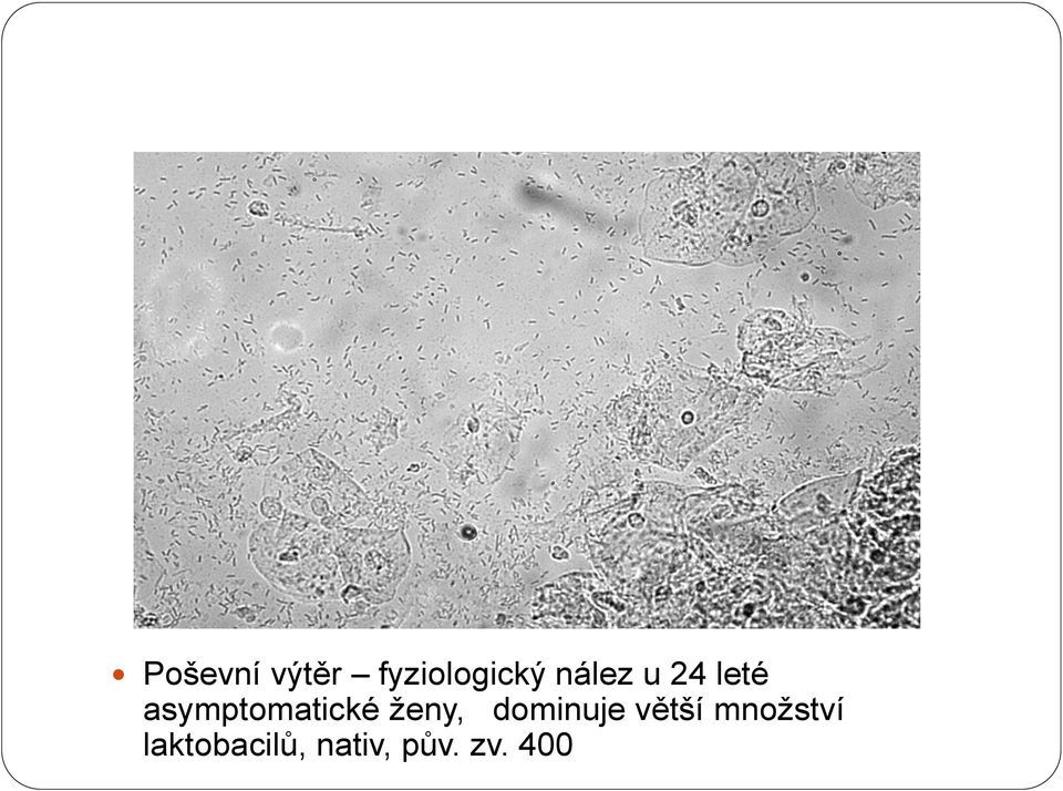 asymptomatické ženy, dominuje