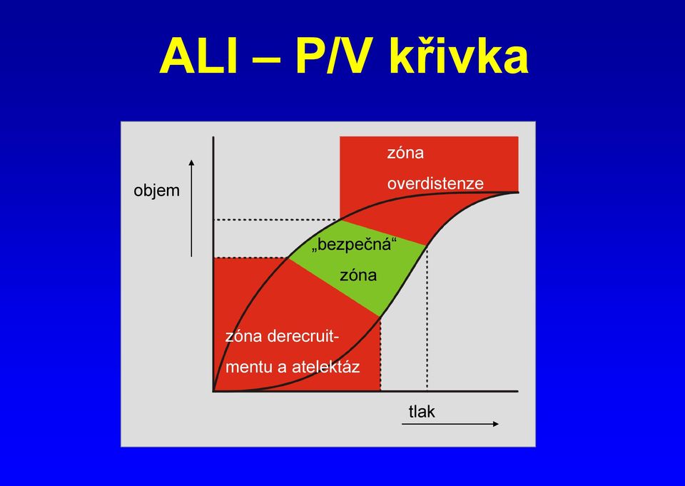 bezpečná zóna zóna