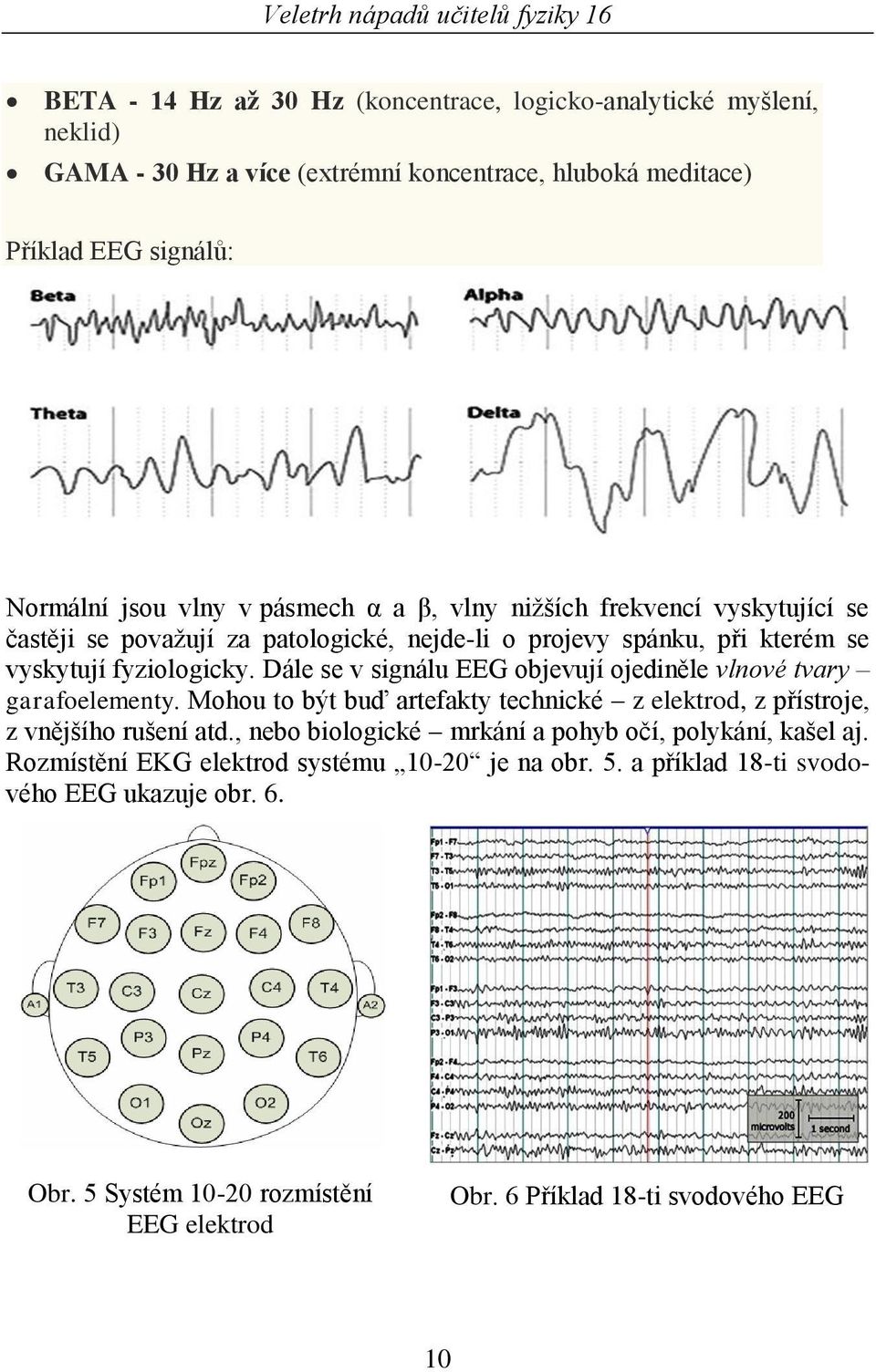 Dále se v signálu EEG objevují ojediněle vlnové tvary garafoelementy. Mohou to být buď artefakty technické z elektrod, z přístroje, z vnějšího rušení atd.