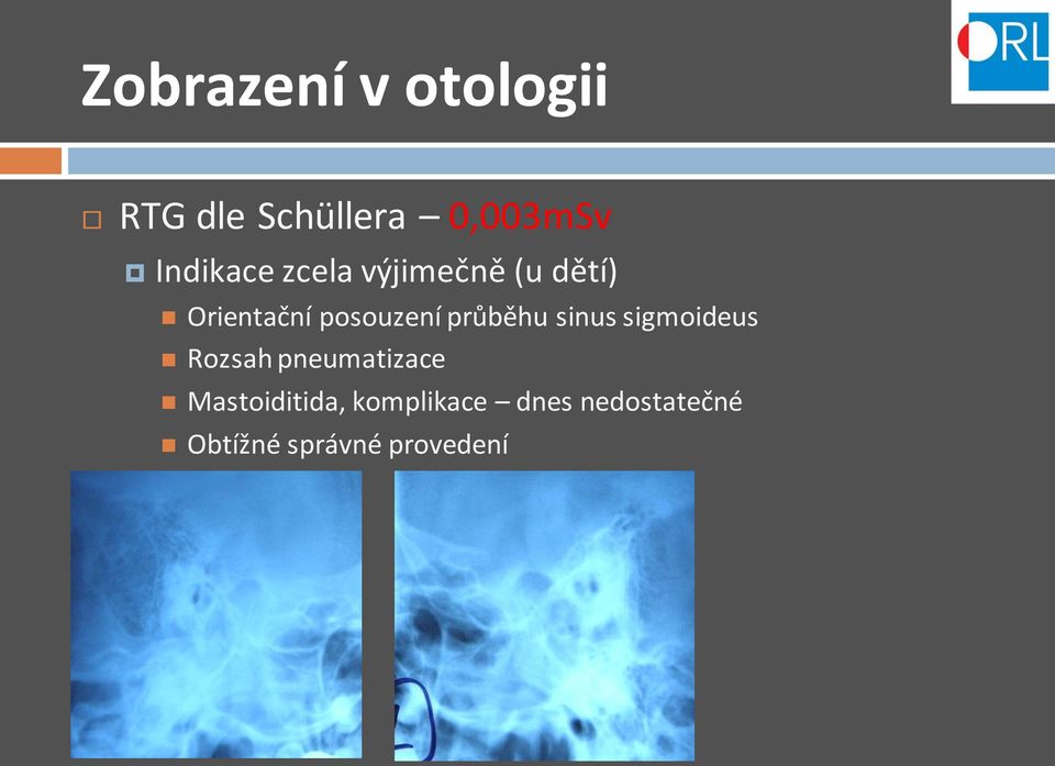 posouzení průběhu sinus sigmoideus Rozsah