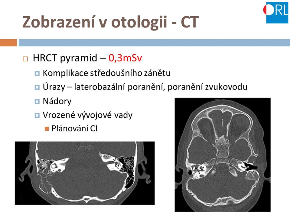 Úrazy laterobazální poranění, poranění