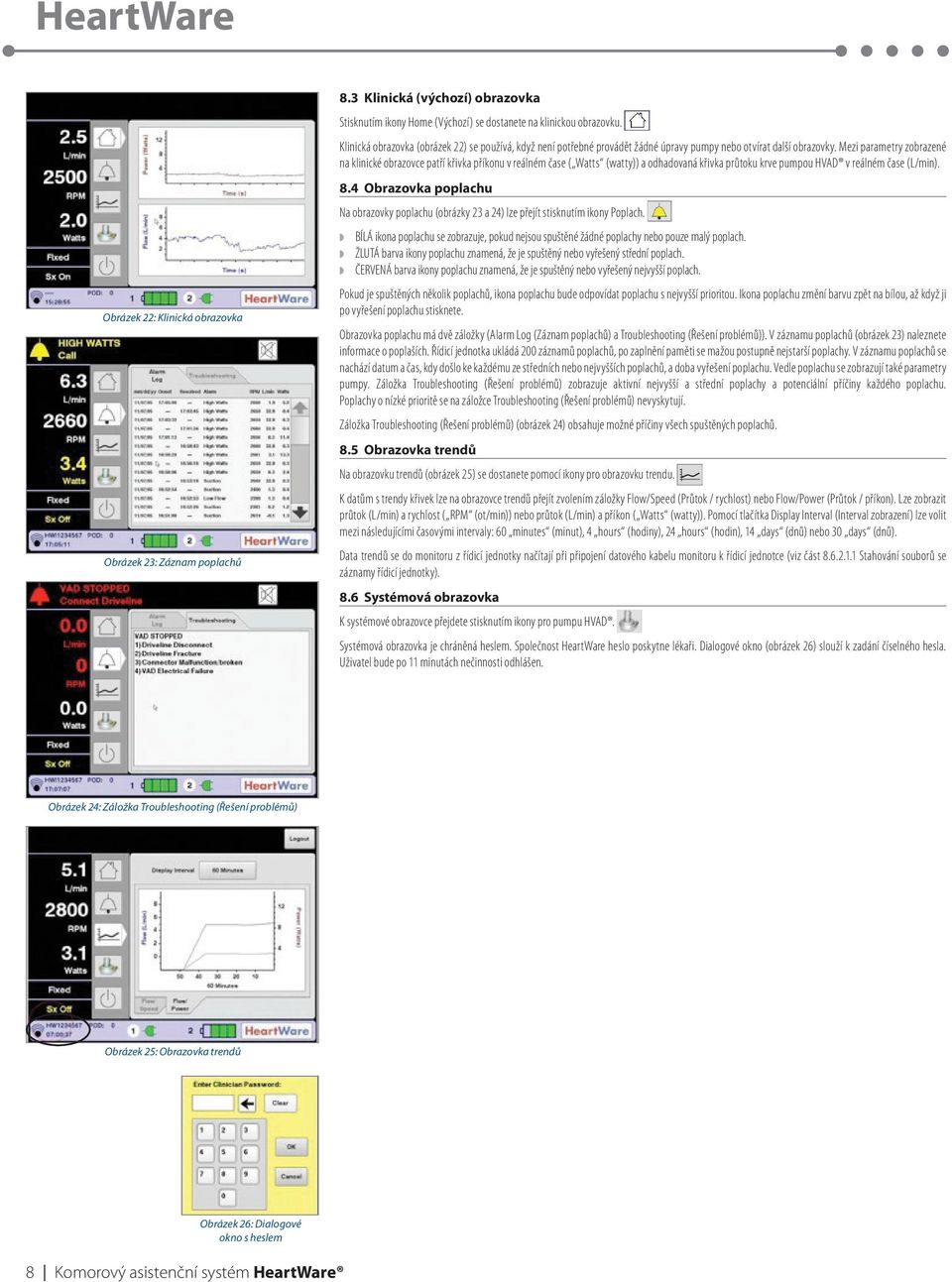 Mezi parametry zobrazené na klinické obrazovce patří křivka příkonu v reálném čase ( Watts (watty)) a odhadovaná křivka průtoku krve pumpou HVAD v reálném čase (L/min). 8.