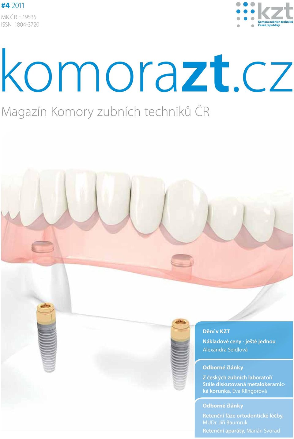 Alexandra Seidlová Odborné články Z českých zubních laboratoří Stále diskutovaná