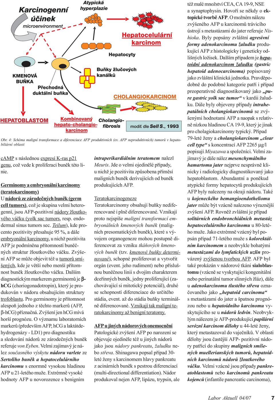 Germinomy a embryonální karcinomy (teratokarcinomy) U nádorù ze zárodeèných bunìk (germ cell tumors), což je skupina velmi heterogenní, jsou AFP-pozitivní nádory žloutkového váèku (yolk sac tumors,