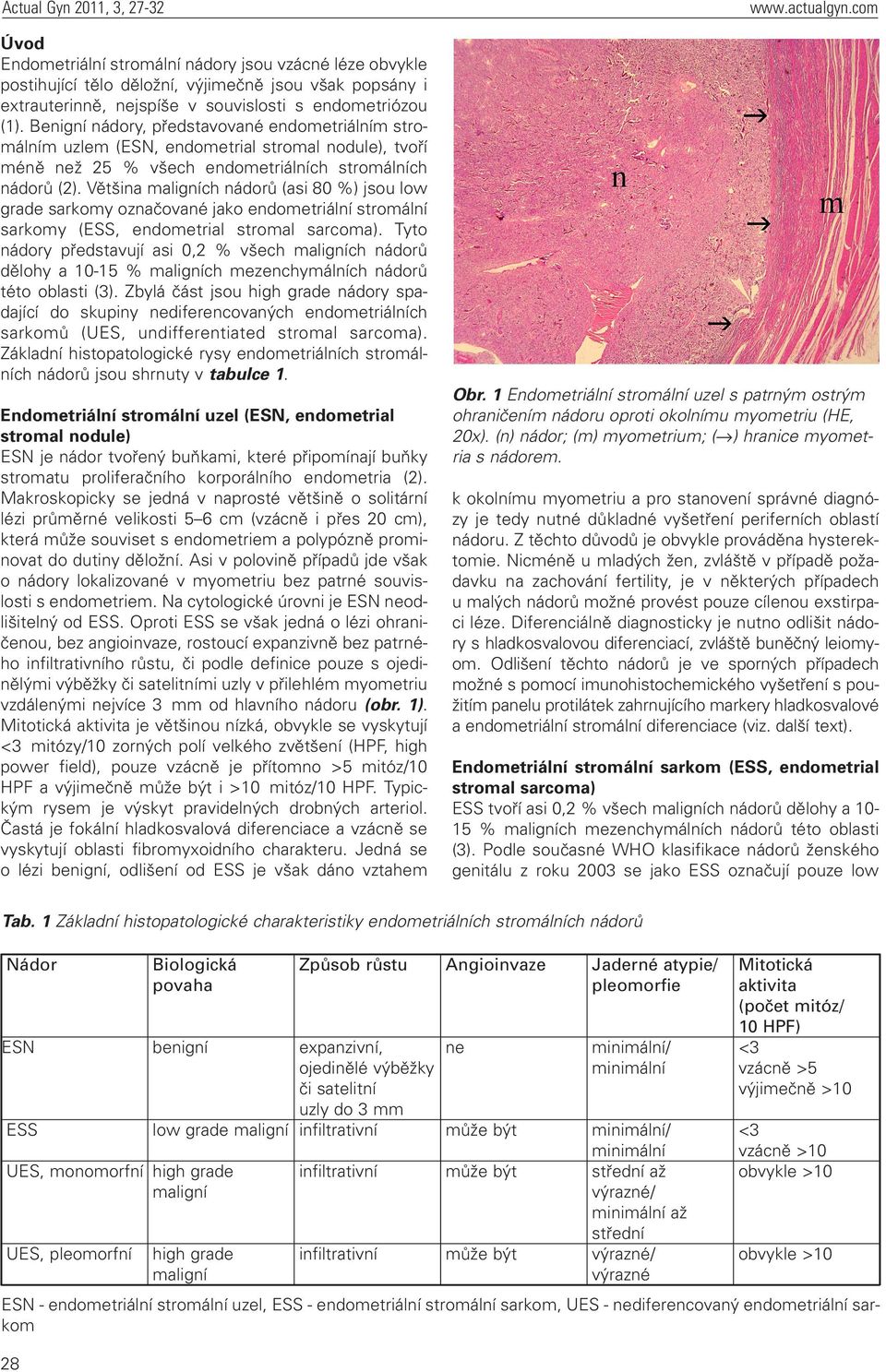 Většina maligních nádorů (asi 80 %) jsou low grade sarkomy označované jako endometriální stromální sarkomy (ESS, endometrial stromal sarcoma).