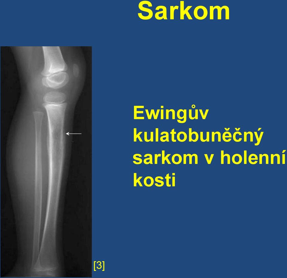 kulatobuněčný