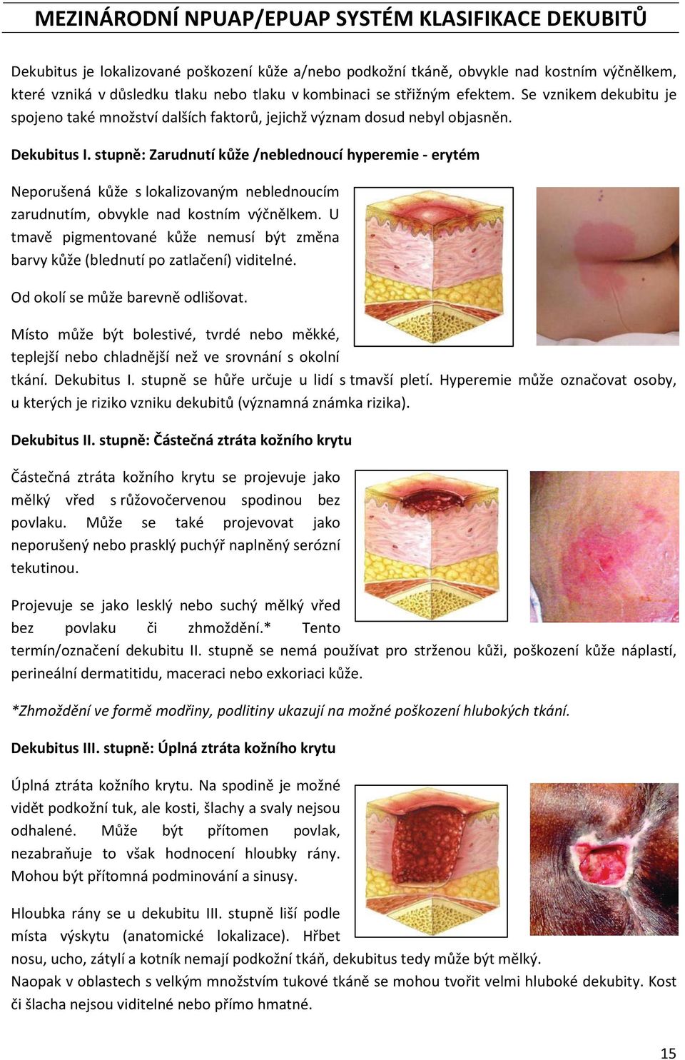 stupně: Zarudnutí kůže /neblednoucí hyperemie - erytém Neporušená kůže s lokalizovaným neblednoucím zarudnutím, obvykle nad kostním výčnělkem.