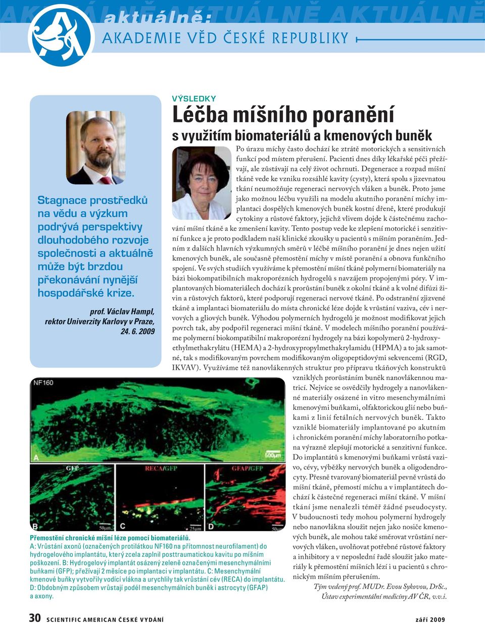 A: Vrůstání axonů (označených protilátkou NF160 na přítomnost neurofilament) do hydrogelového implantátu, který zcela zaplnil posttraumatickou kavitu po míšním poškození.