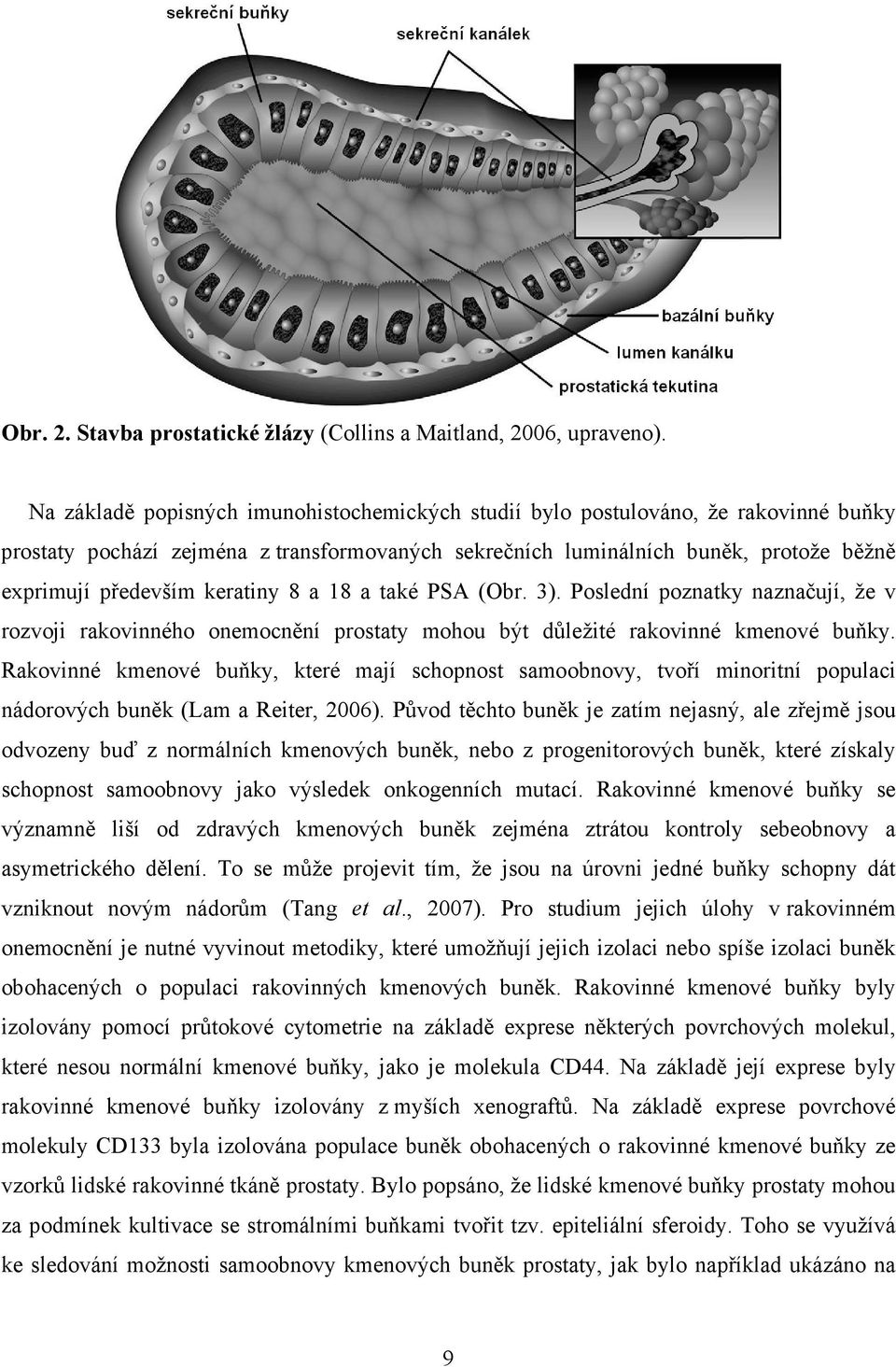 keratiny 8 a 18 a také PSA (Obr. 3). Poslední poznatky naznačují, že v rozvoji rakovinného onemocnění prostaty mohou být důležité rakovinné kmenové buňky.