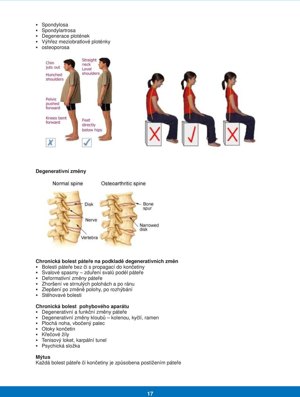 změně polohy, po rozhýbání Stěhovavé bolesti Chronická bolest pohybového aparátu Degenerativní a funkční změny páteře Degenerativní změny kloubů kolenou, kyčlí, ramen
