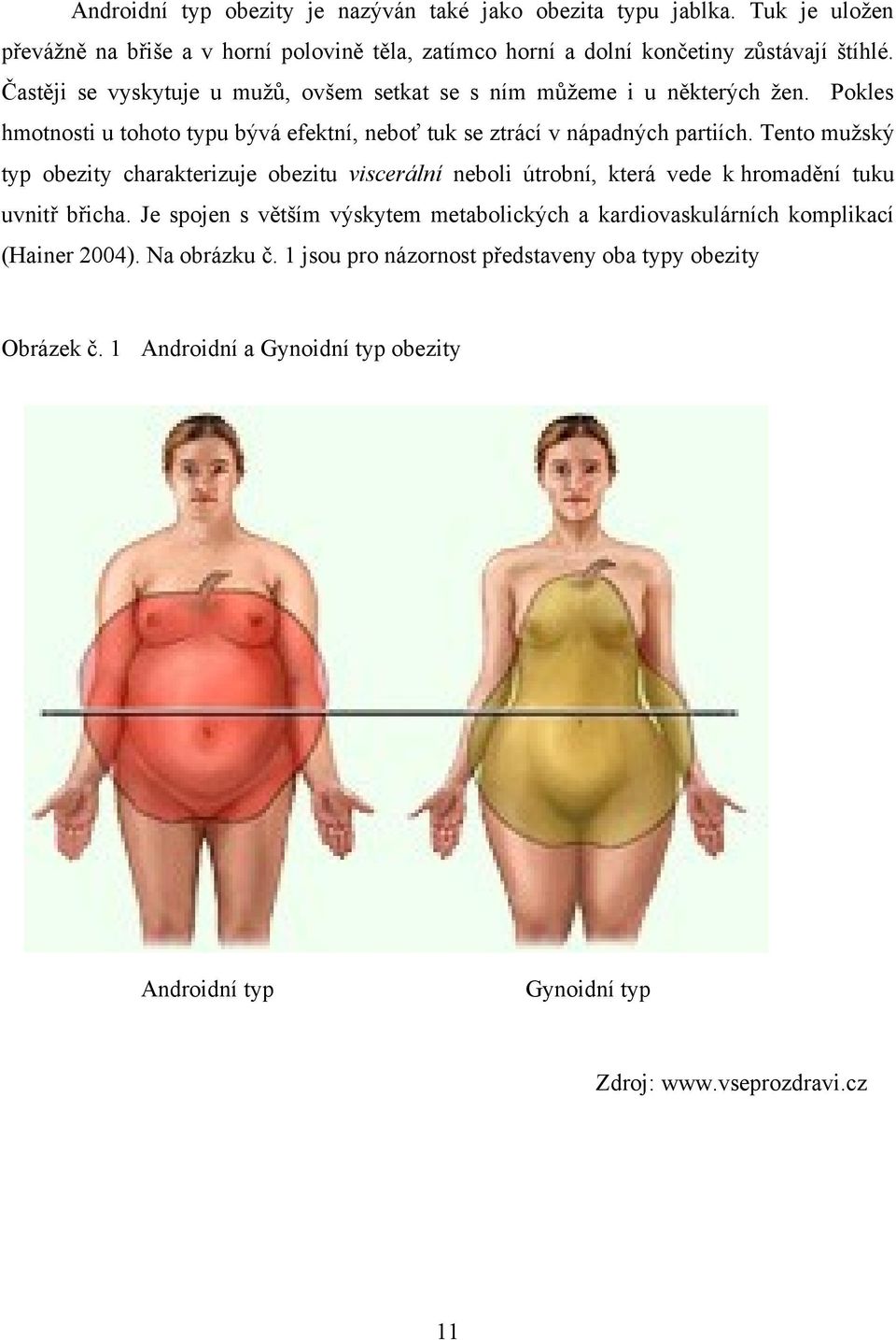 Tento muţský typ obezity charakterizuje obezitu viscerální neboli útrobní, která vede k hromadění tuku uvnitř břicha.