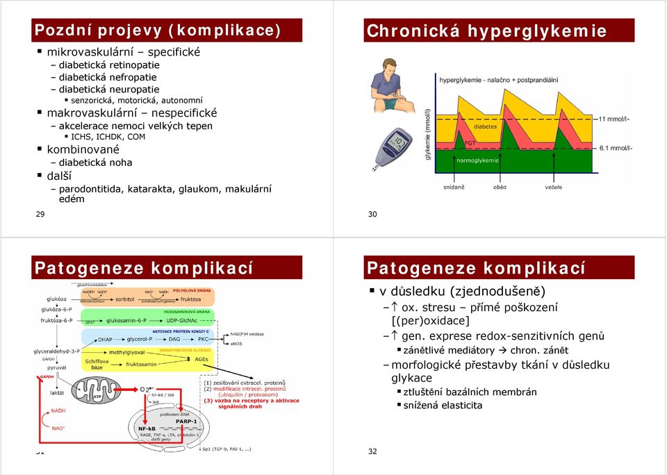 edém 29 Chronická hyperglykemie 30 Patogeze komplikací Patogeze komplikací v důsledku (zjednodušeně) ox. stresu přímé poškození [(per)oxidace] gen.