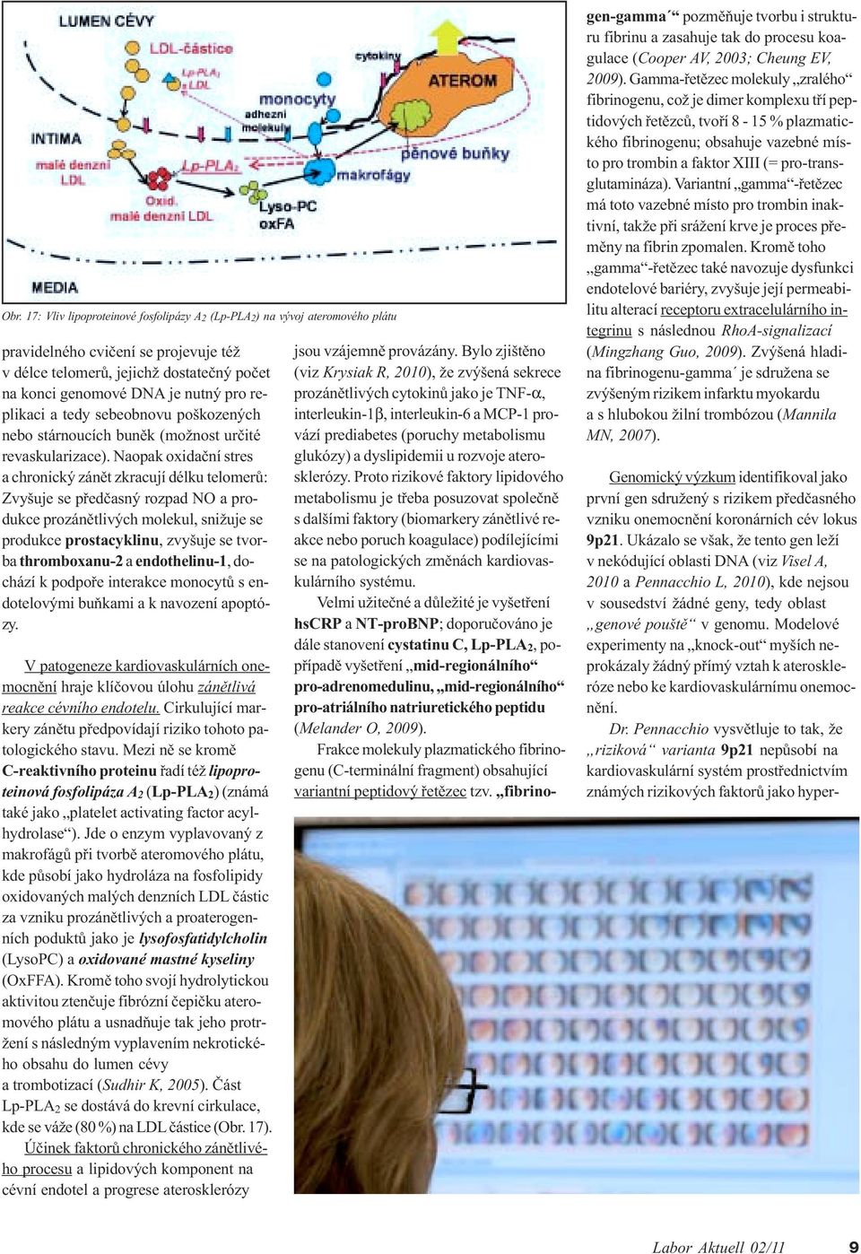 Naopak oxidaèní stres a chronický zánìt zkracují délku telomerù: Zvyšuje se pøedèasný rozpad NO a produkce prozánìtlivých molekul, snižuje se produkce prostacyklinu, zvyšuje se tvorba thromboxanu-2 a