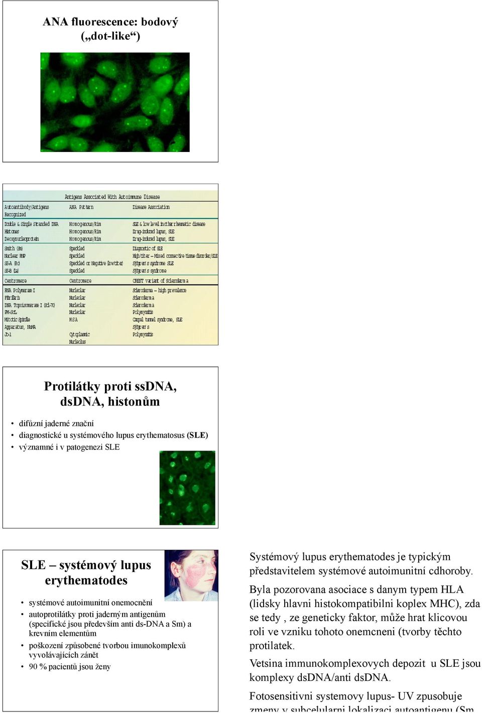 m antigen(m (specifické jsou p%edev"ím anti ds-dna a Sm) a krevním element(m po"kození zp(sobené tvorbou imunokomplex( vyvolávajících zán#t 90 % pacient( jsou &eny Systémov!